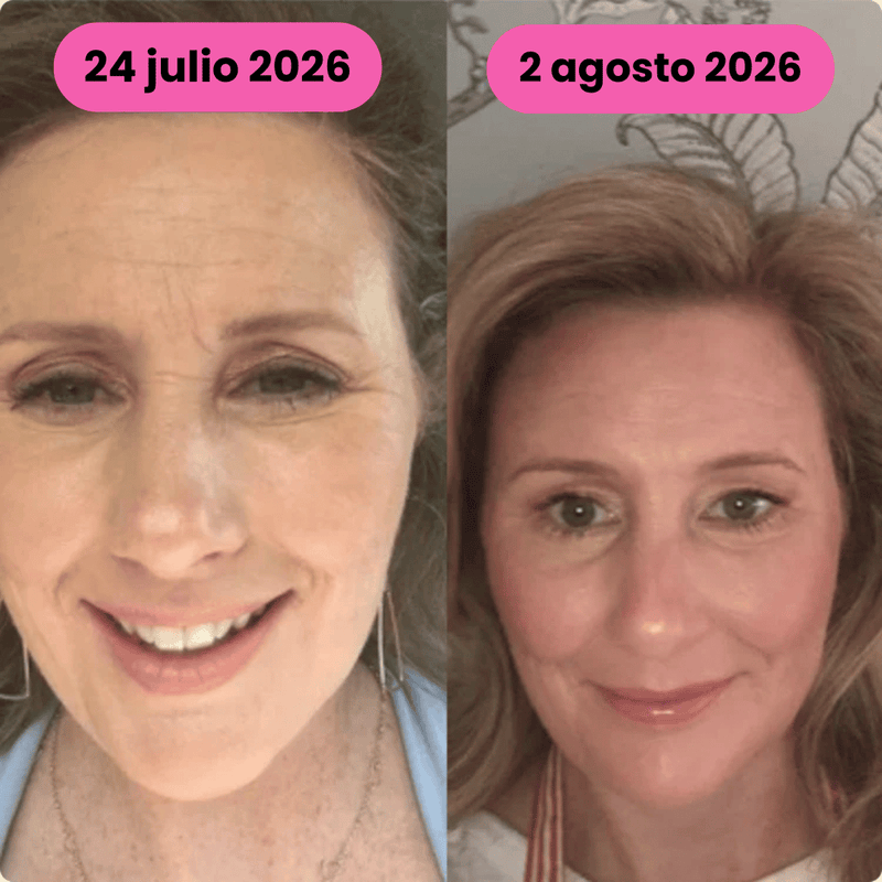 Antes