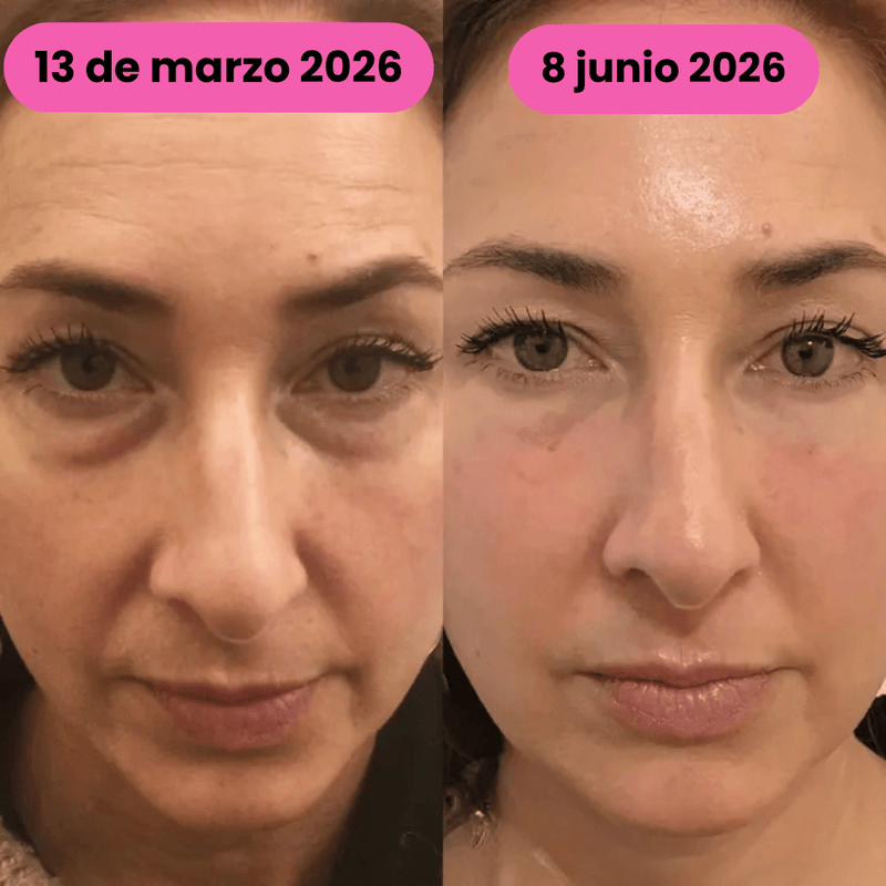 Antes
